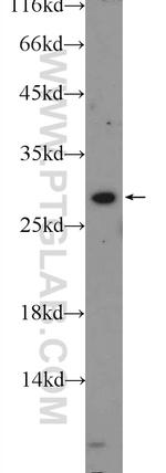 USE1 Antibody in Western Blot (WB)