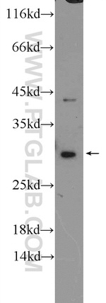 USE1 Antibody in Western Blot (WB)
