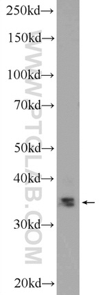 SLMAP Antibody in Western Blot (WB)