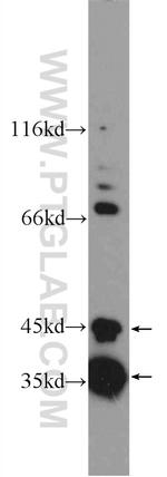 SLMAP Antibody in Western Blot (WB)
