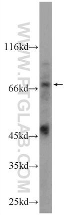 DTX4 Antibody in Western Blot (WB)