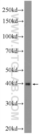 UCP5 Antibody in Western Blot (WB)