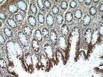 KLHL28 Antibody in Immunohistochemistry (Paraffin) (IHC (P))