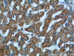 KLHL28 Antibody in Immunohistochemistry (Paraffin) (IHC (P))