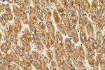 KLHL28 Antibody in Immunohistochemistry (Paraffin) (IHC (P))