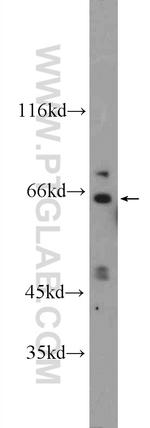 KLHL28 Antibody in Western Blot (WB)