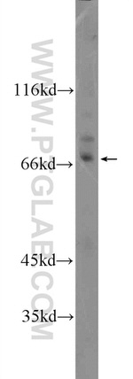 KLHL28 Antibody in Western Blot (WB)