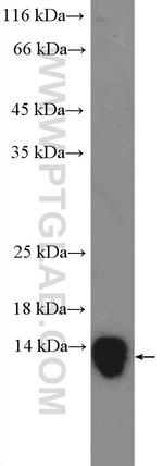 Galectin 10 Antibody in Western Blot (WB)
