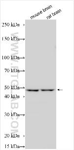 TRPA1 Antibody in Western Blot (WB)