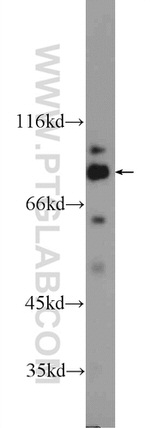 IFT80 Antibody in Western Blot (WB)