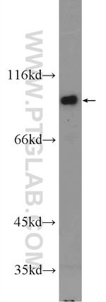 IFT80 Antibody in Western Blot (WB)