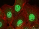 CCAR1 Antibody in Immunocytochemistry (ICC/IF)