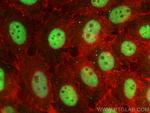 CCAR1 Antibody in Immunocytochemistry (ICC/IF)