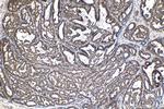 CCAR1 Antibody in Immunohistochemistry (Paraffin) (IHC (P))
