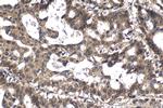 CCAR1 Antibody in Immunohistochemistry (Paraffin) (IHC (P))