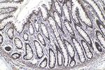 CCAR1 Antibody in Immunohistochemistry (Paraffin) (IHC (P))