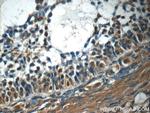 KIAA0430 Antibody in Immunohistochemistry (Paraffin) (IHC (P))