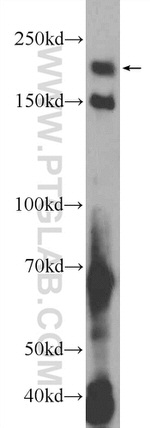KIAA0430 Antibody in Western Blot (WB)