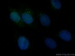 CEP110 Antibody in Immunocytochemistry (ICC/IF)