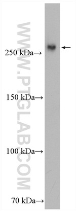 CEP110 Antibody in Western Blot (WB)