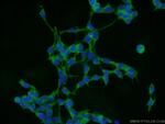 COMMD8 Antibody in Immunocytochemistry (ICC/IF)