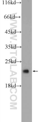 COMMD8 Antibody in Western Blot (WB)