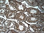 TDRD5 Antibody in Immunohistochemistry (Paraffin) (IHC (P))