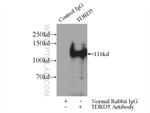 TDRD5 Antibody in Immunoprecipitation (IP)