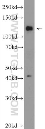 FNDC3A Antibody in Western Blot (WB)