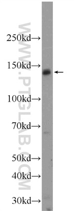 FNDC3A Antibody in Western Blot (WB)