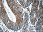 PHLPPL Antibody in Immunohistochemistry (Paraffin) (IHC (P))