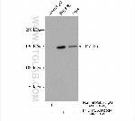 PHLPPL Antibody in Immunoprecipitation (IP)