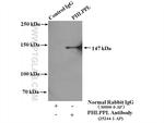 PHLPPL Antibody in Immunoprecipitation (IP)