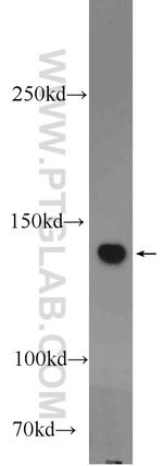 PHLPPL Antibody in Western Blot (WB)