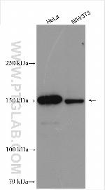 PHLPPL Antibody in Western Blot (WB)