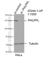 PHLPPL Antibody in Western Blot (WB)