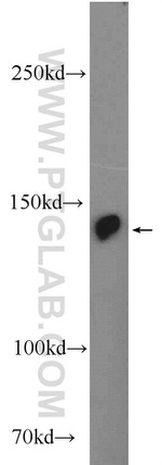 PHLPPL Antibody in Western Blot (WB)