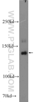 PHLPPL Antibody in Western Blot (WB)