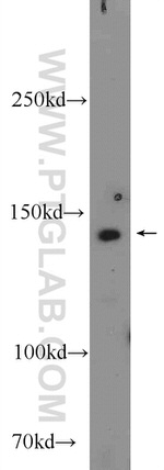 PHLPPL Antibody in Western Blot (WB)