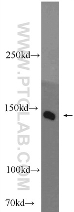 PHLPPL Antibody in Western Blot (WB)