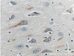 GPR103 Antibody in Immunohistochemistry (Paraffin) (IHC (P))