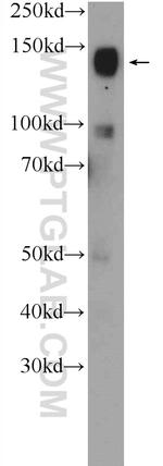 CHL1 Antibody in Western Blot (WB)