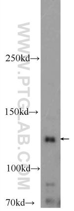 GUCY2F Antibody in Western Blot (WB)