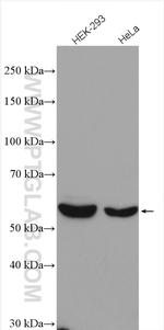 TBC1D24 Antibody in Western Blot (WB)