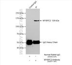 MYBPC2 Antibody in Immunoprecipitation (IP)