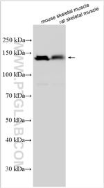MYBPC2 Antibody in Western Blot (WB)