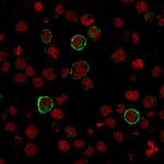 CD15/FUT4 (Reed-Sternberg Cell Marker) Antibody in Immunocytochemistry (ICC/IF)