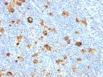 CD15/FUT4 (Reed-Sternberg Cell Marker) Antibody in Immunohistochemistry (Paraffin) (IHC (P))