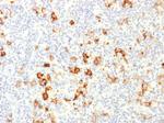 CD15/FUT4 (Reed-Sternberg Cell Marker) Polyclonal Antibody