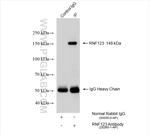 RNF123 Antibody in Immunoprecipitation (IP)